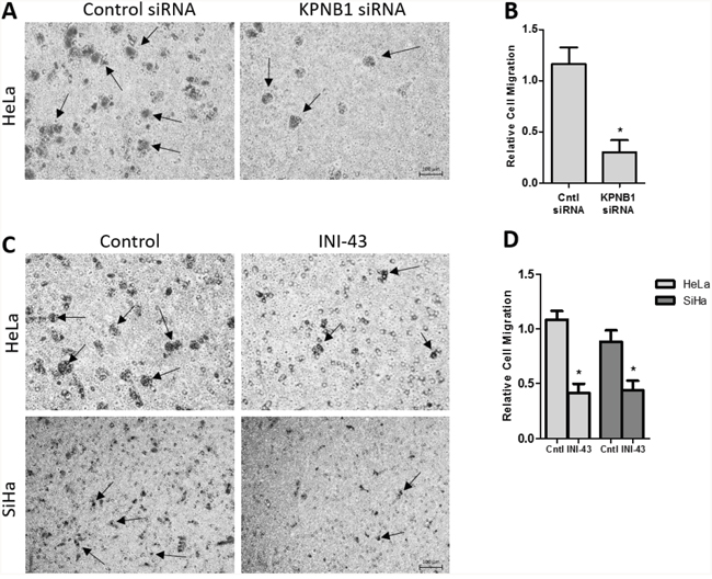 Effect of KPNB1 inhibition on cervical cancer cell migration.