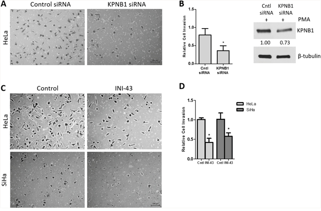 Effect of KPNB1 inhibition on cervical cancer cell invasion.