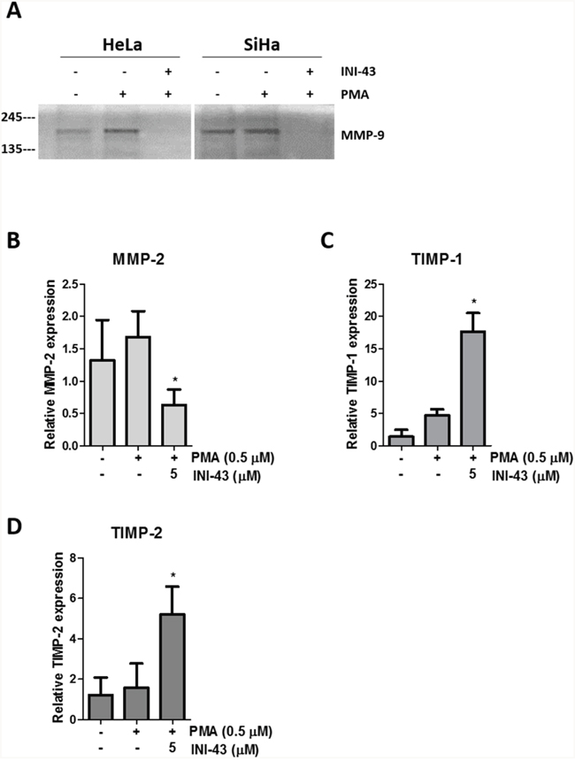 KPNB1 inhibition affects MMP-9 activity and MMP-2, TIMP-1 and TIMP-2 expression.