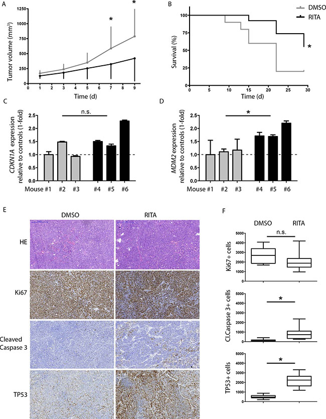 RITA treatment has anti-tumoral activity against medulloblastoma tumor xenografts in mice.