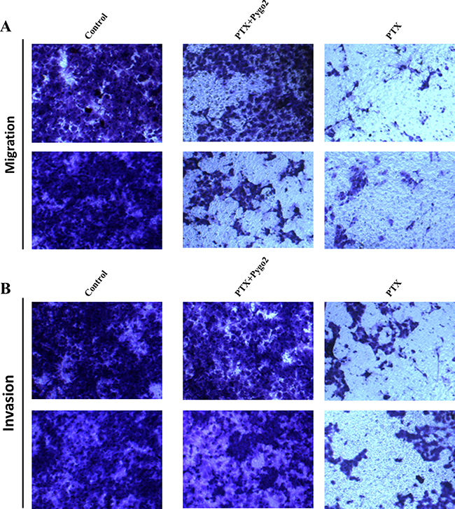 Effect of Pygo2 on cell metastasis of U-87MG cells treated with PTX.
