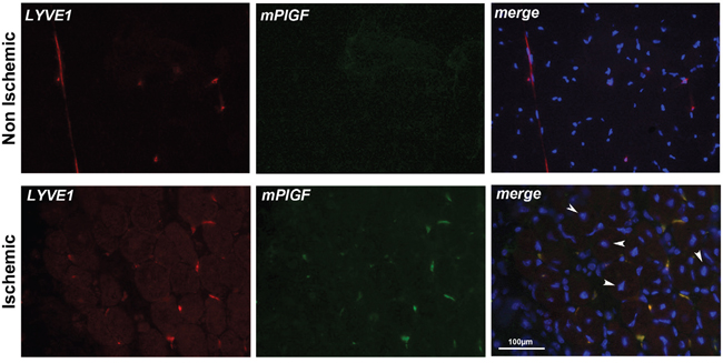 PlGF co-localizes with LYVE1 positive lymphatic vessels in ischemic muscle.