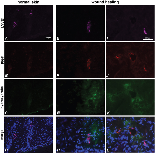 PlGF and LYVE1 co-localize in hypoxic area of skin during wound healing.