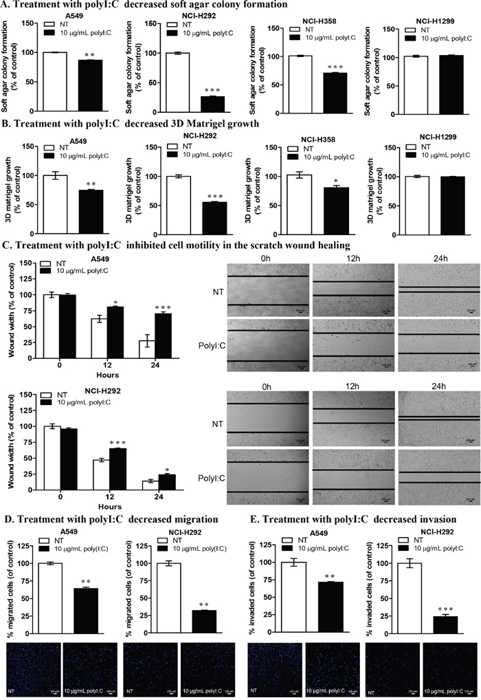 PolyI:C suppresses oncogenicity, cellular motility, migration and invasion of A549 and NCI-H292 cells.