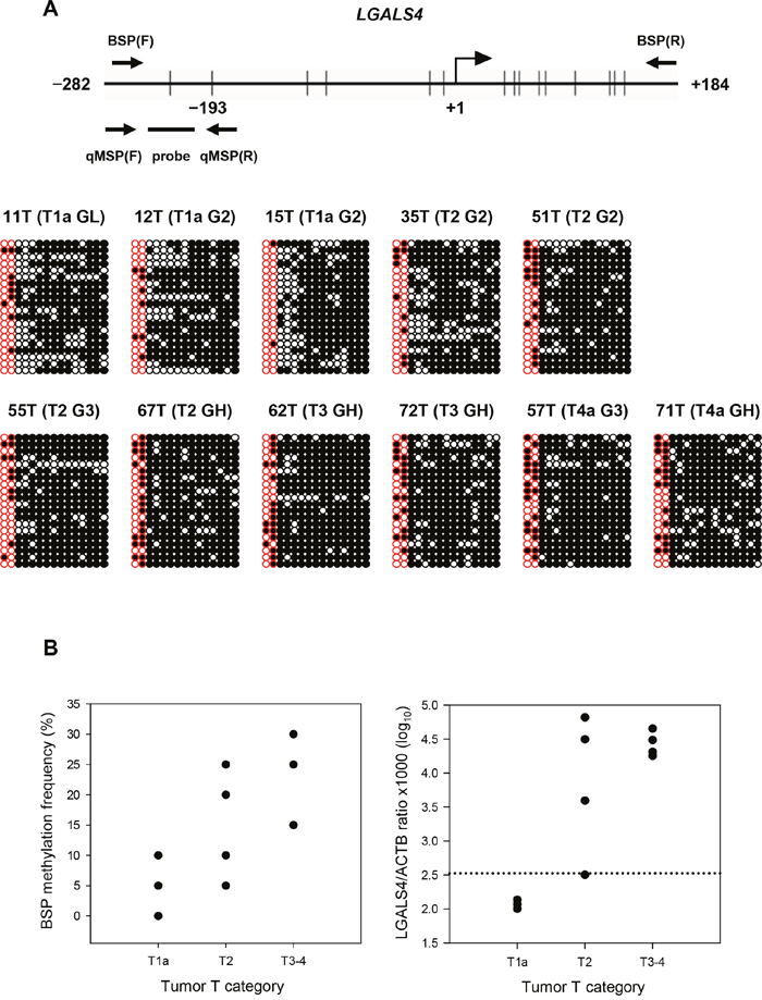 Results of bisulfite sequencing PCR (BSP) and a comparison of LGALS4 CpG methylation levels with the results of quantitative MSP (qMSP) assay using 11 samples of UC.