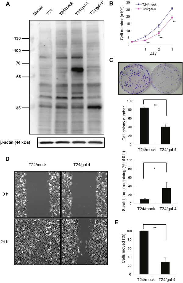 Effects of LGALS4 protein expression (gal-4) in T24 transfectants.