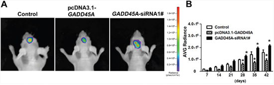 GADD45A inhibits tumor growth in vitro.