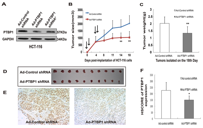 Kockdown of PTBP1 generally inhibited tumor growth in vivo.