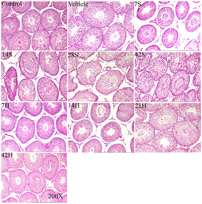 Representative photomicrographs of testicular H&#x0026;E stained slices in the control group (control), vehicle group(vehicle), hSCI groups(7S, 14S, 28S, 42S) and HRST groups (7, 14, 28, and 42 h).