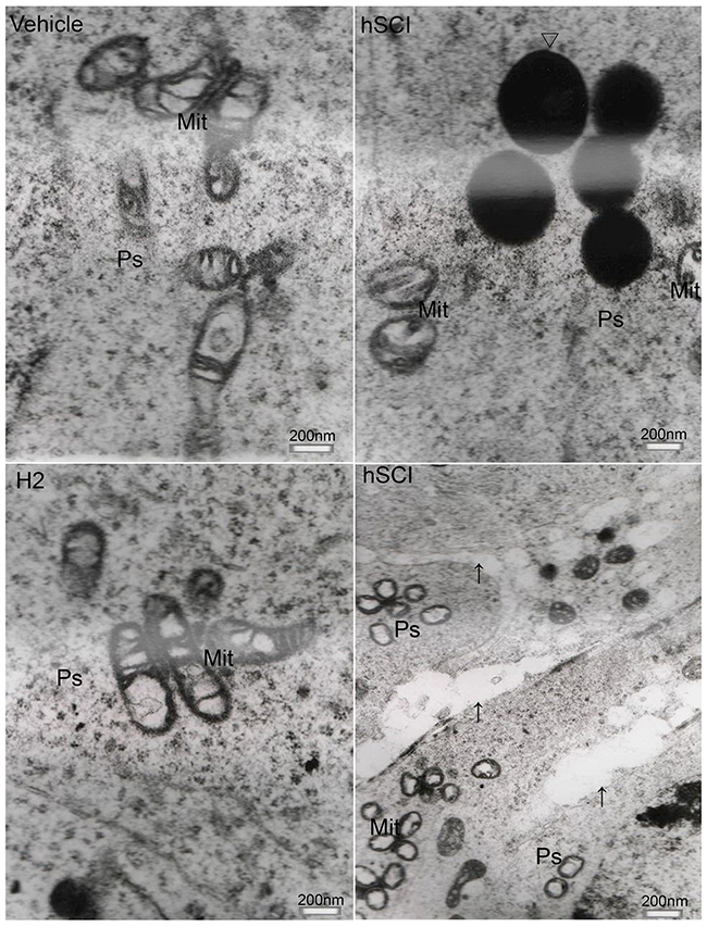 Ultrastructural changes of primary spermatocytes.