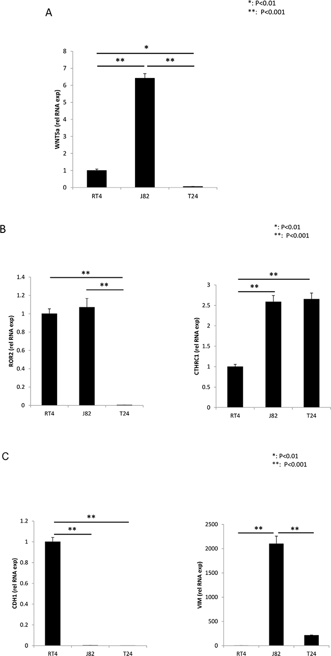 Real Time RT-PCR, analysis of RNA expression.