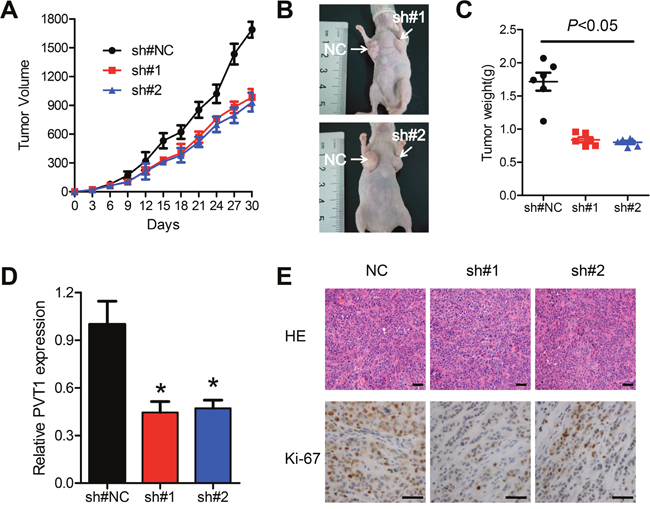 Knockdown of PVT1 suppresses ESCC tumor growth in vivo.