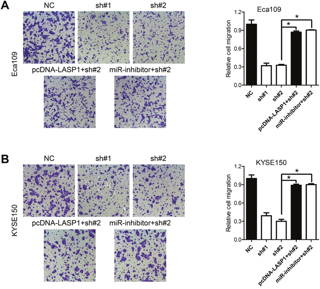 LASP1 expression mediated the biological effects exerted by PVT1.
