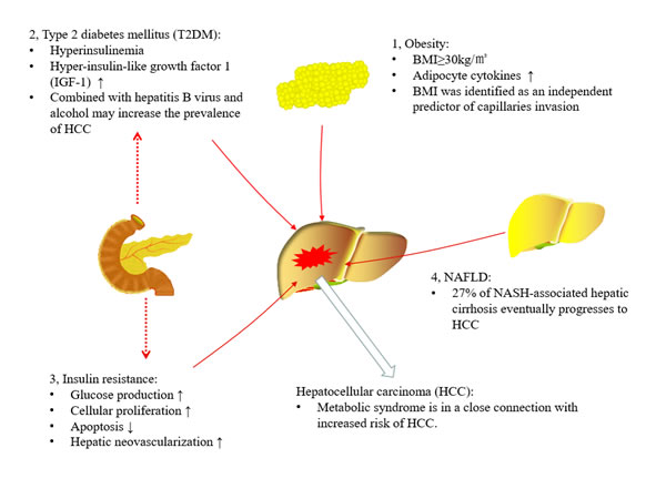 Association between metabolic syndrome and hepatocellular carcinoma (HCC).