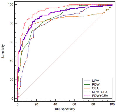 Receiver-Operator Characteristics (ROC) curve for MPV, PDW, and CEA combined showing sensitivity and 1-specificity of the differential diagnosis of gastric cancer