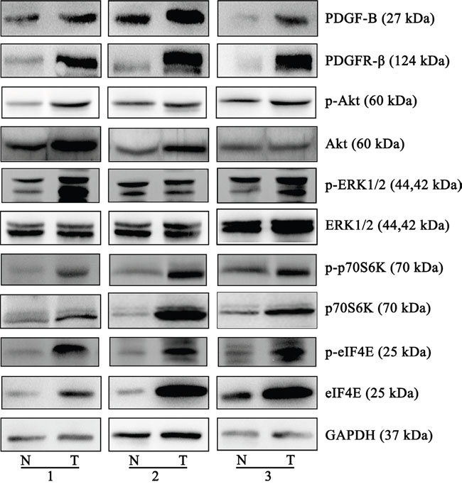 Western blots of the proteins of PDGF-B signaling pathway.