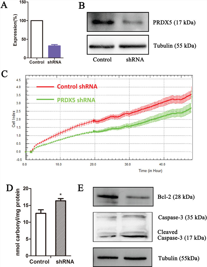 PRDX5 knockdown results in growth inhibition of gastric cancer cell line.