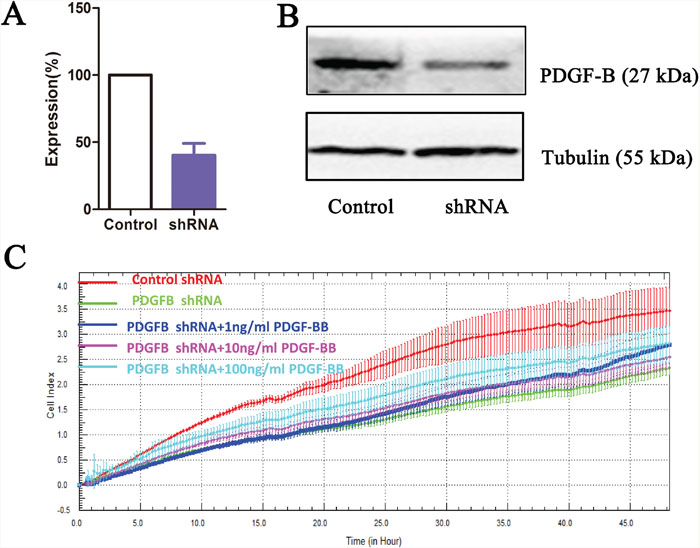 PDGF-B knockdown results in growth inhibition of gastric cancer cell line.