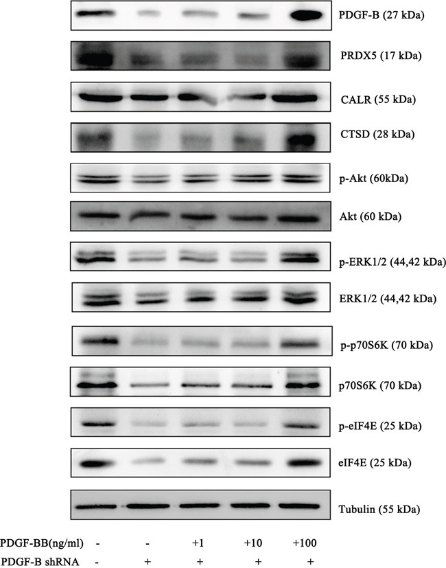 Western Blot results of PRDX5, CTSD, eIF4E, p70S6K and Akt in negative control cells, PDGF-B Knockdown cells and knockdown cells with exogenous PDGF-BB.
