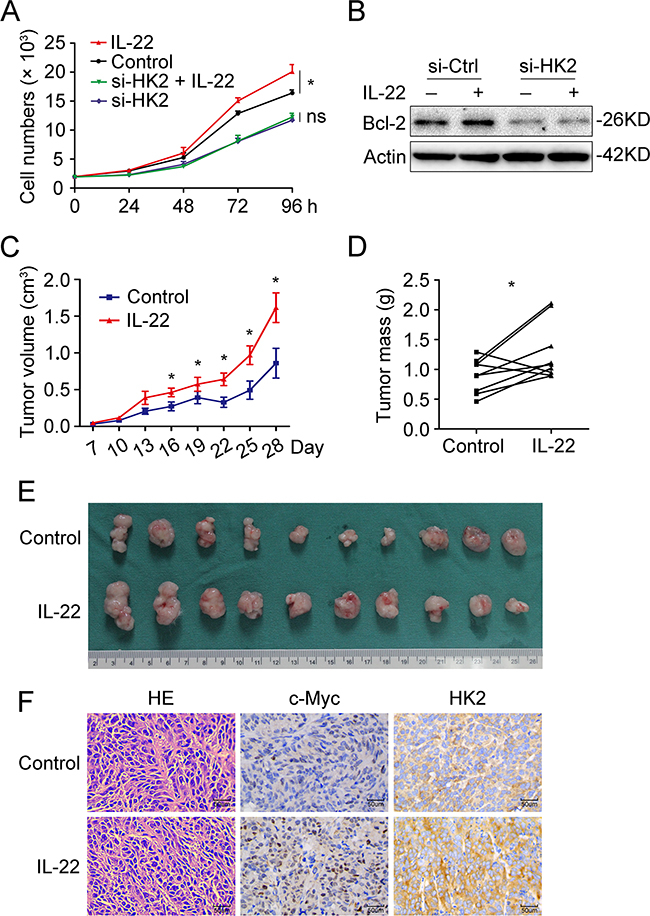 HK-2 partly accounted for IL22-mediated cell proliferation in colon cancer cells.