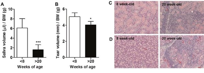 Development of Sj&#x00F6;gren&#x2019;s syndrome (SS) occurred in over 20-week-old male NOD mice.