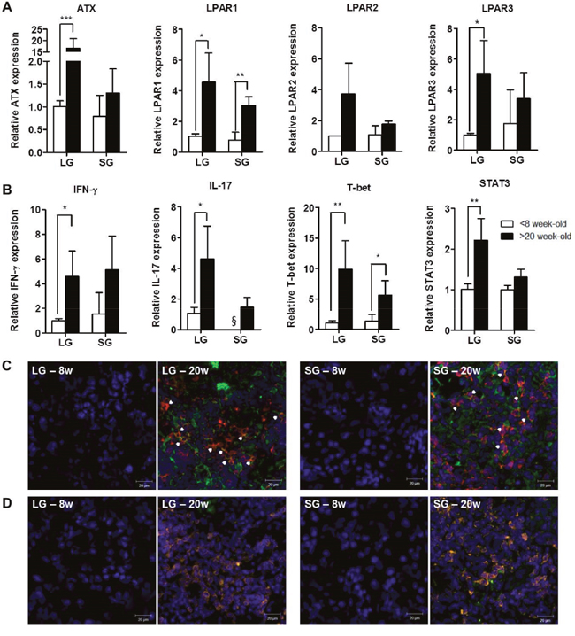 Expression of autotaxin, LPARs, and IL-17 was increased in exocrine glands from NOD mice with SS.