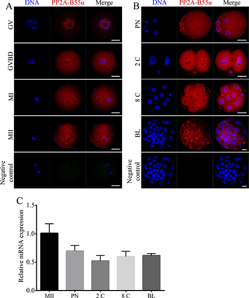 Localization and expression patterns of PP2A-B55&#x03B1; in mouse oocytes and preimplantation embryos.