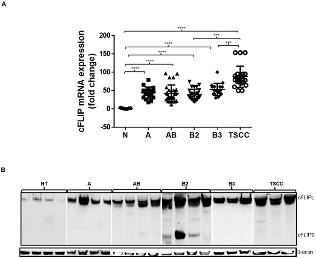 cFLIP mRNA and protein expression analysis.