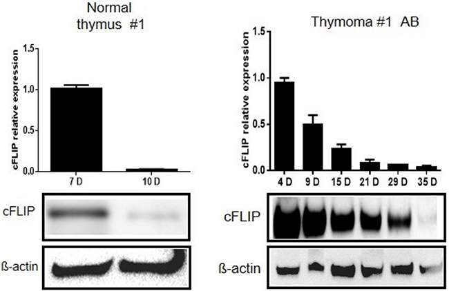 Slower decline of cFLIP mRNA and protein levels in thymoma primary epithelial cells compared to primary epithelial cells from normal thymus.