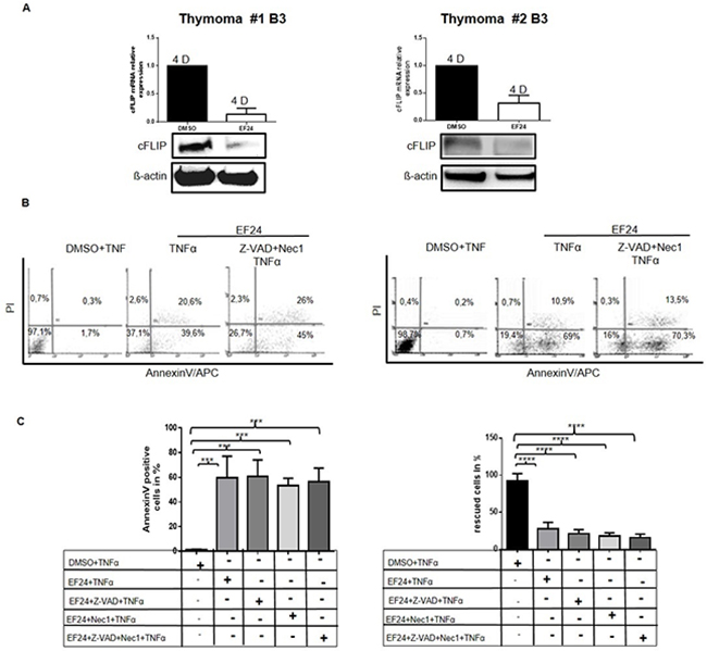 Cultured TECs are highly sensitive towards NF-&#x03BA;B inhibition and can not be rescued from cell death by inhibition of caspases and necroptosis pTECs from two B3 thymomas were first pretreated with Z-VAD-FMK for 1 hour before they were treated in addition with the NF-&#x03BA;B inhibitor, EF24 for 12hours.