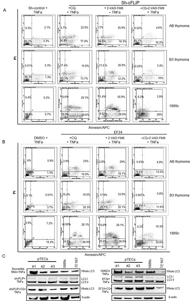 Attenuation of TNF&#x03B1; induced cell death by blocking autophagy and apoptosis in sh-cFLIP transfected and EF24 treated pTECs Autophagy inhibition by chloroquine (CQ) treatment.