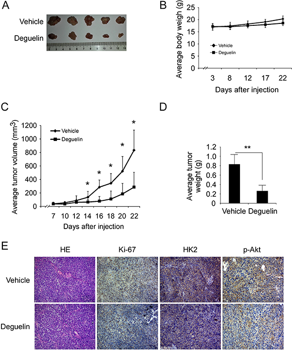 Deguelin inhibits tumor growth in xenograft mouse model.