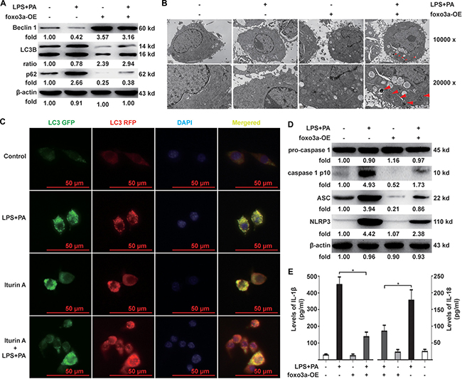 Effects of Foxo3a on autophagy flux and activation of the NLRP3 inflammasome in KCs.