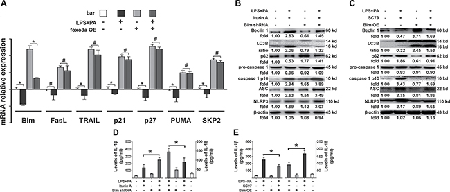 Patterns of Foxo3a restoration of the autophagy program.