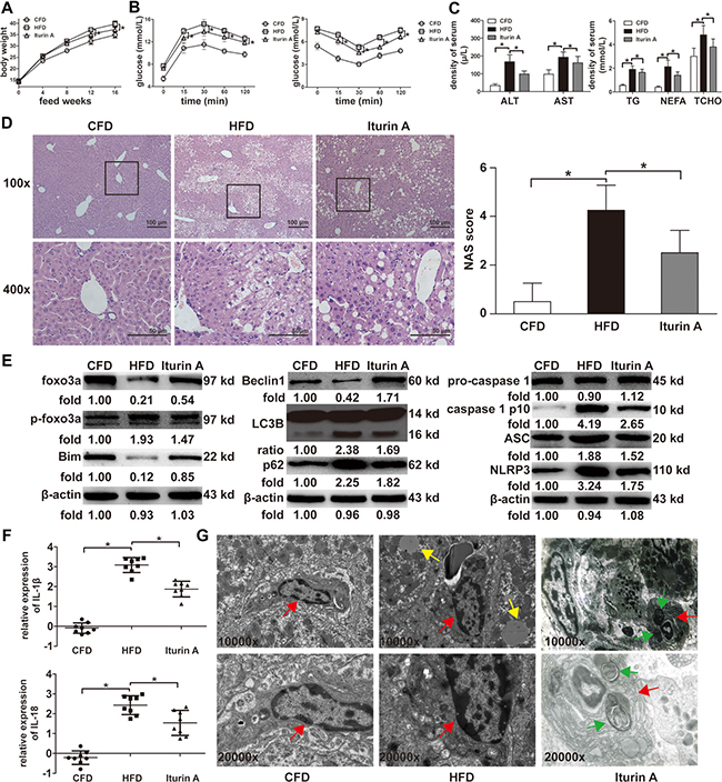 Effects of Foxo3a on mice feed with a HFD.