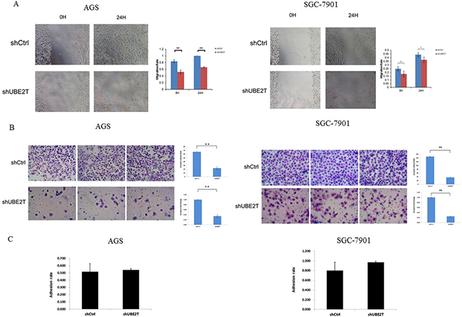 Suppression of UBE2T attenuates invasion and metastasis in gastric cancer cells.