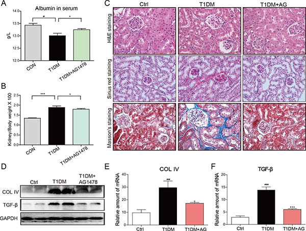 AG1478 attenuate diabetes-induced renal histological abnormalities and fibrosis.
