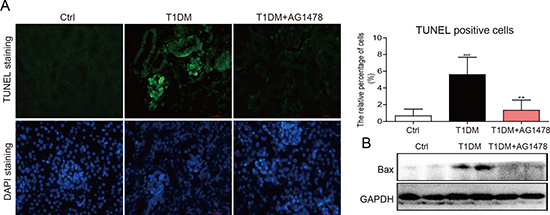 AG1478 mitigate apoptosis in diabetic kidney.