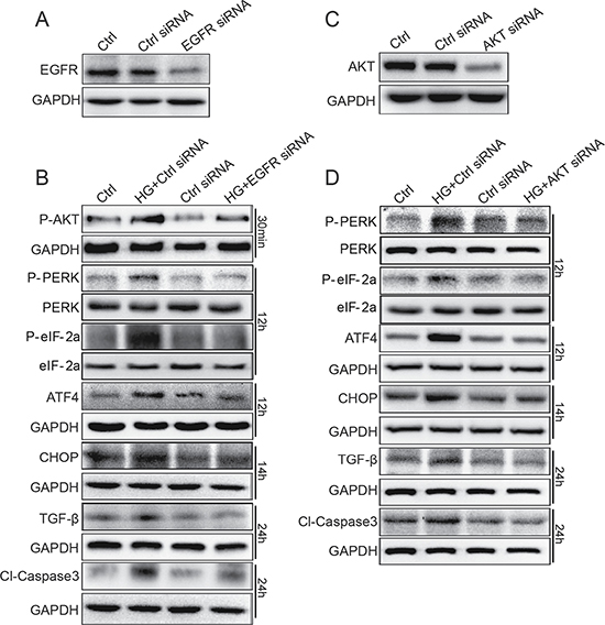 EGFR and AKT mediate HG-induced ER stress and cell damage in SV40 MES 13 cells.