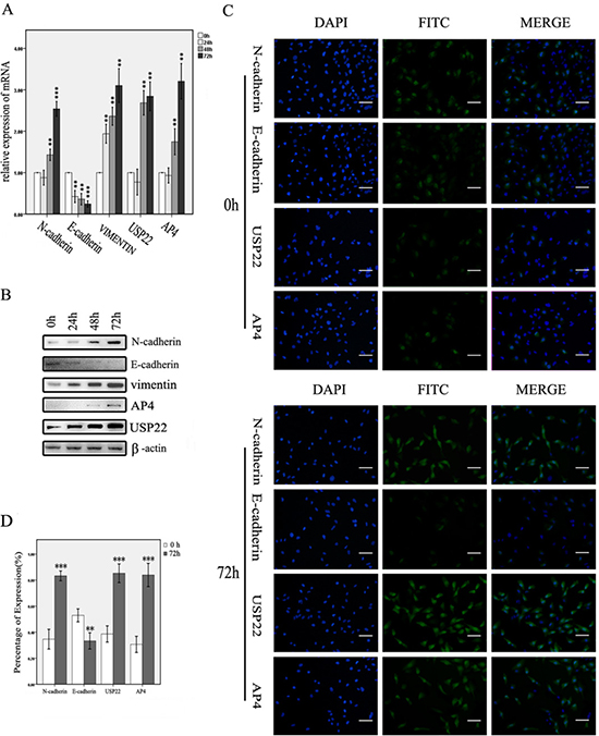 USP22 and AP4 expression in TGF-&#x03B2;1-induced EMT cells.