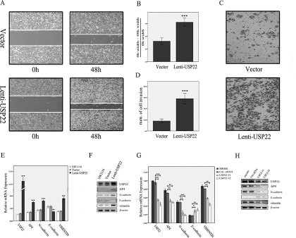 Effects of USP22 up- and down-regulation on CRC cells.