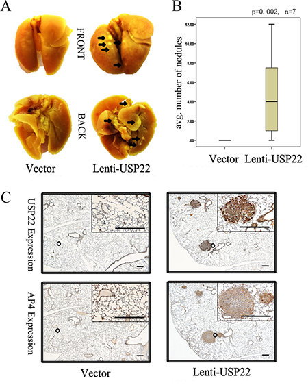 USP22 promotes lung metastasis of CRC cells in nude mice.