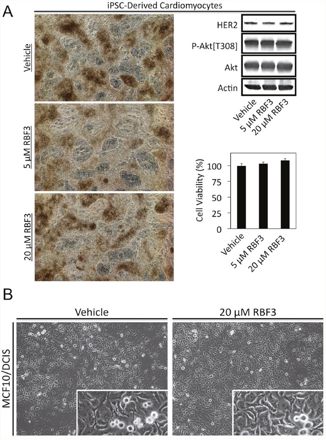 DDAs are not toxic to cardiomyocytes or MCF10/DCIS cells.