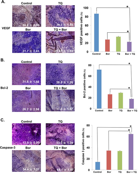 Fig 7: TQ enhances the effect of bortezomib against MM tumor cell proliferation.