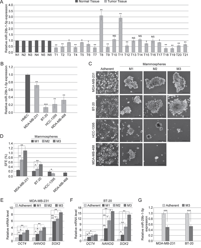 MiR-29b-1-5p expression in TNBC tissues and cell lines, and mammosphere formation ability of TNBC cell lines.