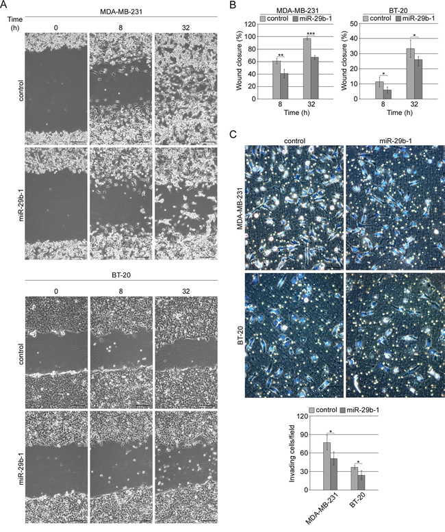MiR-29b-1 overexpression reduces migration and invasion of MDA-MB-231 and BT-20 cell lines.