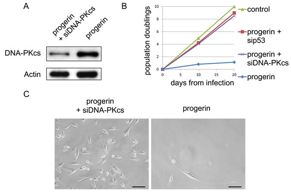 DNA-PKcs knockdown attenuates progerin-induced inhibition of VSMC growth.