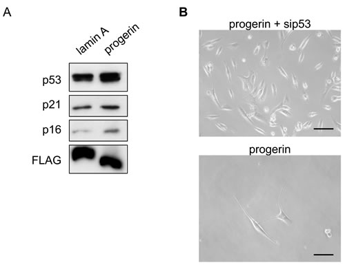 p53 knockdown improves progerin-induced inhibition of VSMC growth.