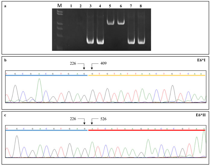 (a) PCR reactions using primer pairs targeting the full-length E6 cDNA (lanes 3-4) and genome viral DNA (lanes 7-8).