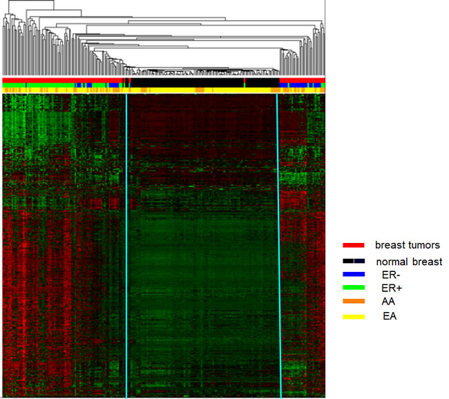 Unsupervised hierarchical cluster analysis of the most varied CpG loci probes among tumor and normal breast tissues  (2,761 probes, SD &gt; 0.189).